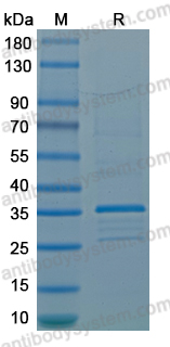 Recombinant LSDV E10R Protein, N-GST & C-His