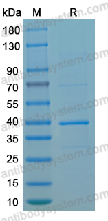 Recombinant LSDV G4L Protein, N-GST & C-His