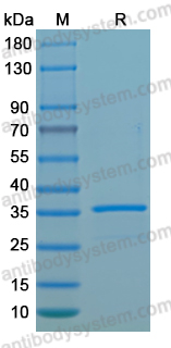 Recombinant LSDV L5R Protein, N-GST & C-His
