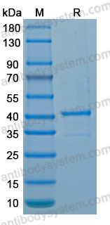 Recombinant LSDV J5L Protein, N-GST & C-His