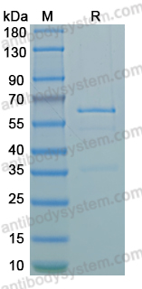 Recombinant LSDV A16L Protein, N-GST & C-His