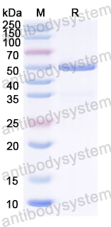Recombinant Common carp CYP19A1 Protein, C-His
