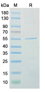 Recombinant Chlamydia trachomatis ompA/MOMP Protein, N-His