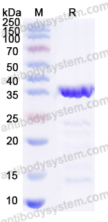 Recombinant Staphylococcus aureus srtA/Sortase A Protein, N-His-SUMO
