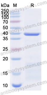 Recombinant Mycoplasma pneumoniae mgpA/Adhesin P1 Protein, N-His