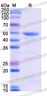 Recombinant Porphyromonas gingivalis kgp/prtK Protein, N-His