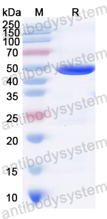 Recombinant Staphylococcus aureus WalK Protein, N-His