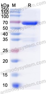 Recombinant Mycoplasma pneumoniae CARDS Protein, N-His