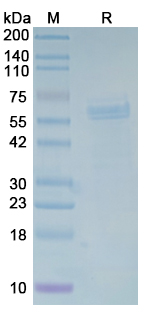 Recombinant Mycoplasma pneumoniae p65 Protein, N-His