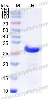 Recombinant Mycoplasma pneumoniae P30 adhesin Protein, N-His