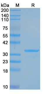 Recombinant Brucella suis omp19 Protein, N-GST & C-His