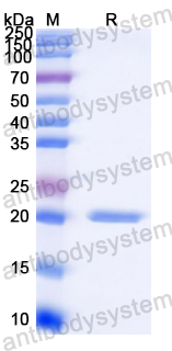 Recombinant Streptococcus pyogenes sortase Protein, N-His