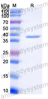 Recombinant Streptococcus pyogenes arp4/IgA receptor Protein, N-His