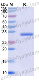 Recombinant Eimeria tenella Membrane-associated calcum-binding protein, related, putative, C-His