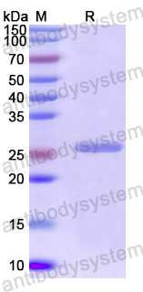 Recombinant Eimeria tenella Microneme protein, putative, C-His