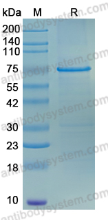 Recombinant Plasmodium falciparum VAR2CSA Protein, C-His