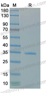 SDS-PAGE for Recombinant Plasmodium vivax LDH Protein, C-His ?>