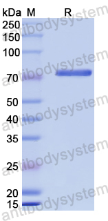 Recombinant Durum wheat TKT/Transketolase Protein, N-His