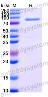 SDS-PAGE for Recombinant Wheat Acc-1 Protein, N-His ?>